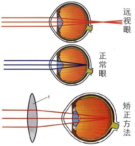 山东青岛验光师加工陪训考证好不好考