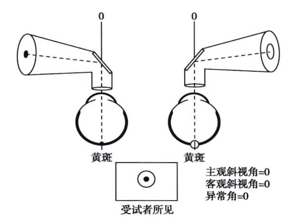 验光师培训，正真视光学院