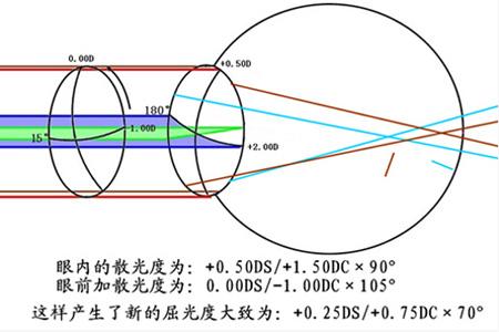 济宁验光师培训课程解析散光是什么