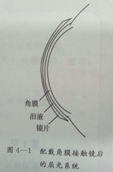 威海验光学校讲述角膜接触镜的顶点焦度换算