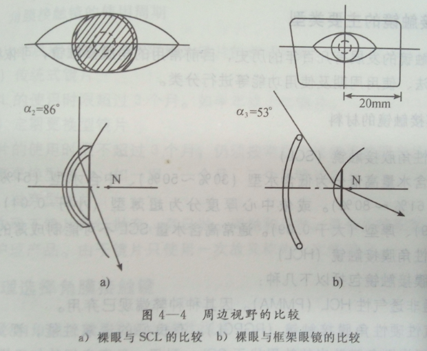 威海验光学校讲述角膜接触镜的优点